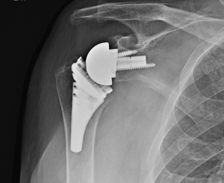 Arthrex - Short - Reverse<br><span>Click image to see a larger version.</span>