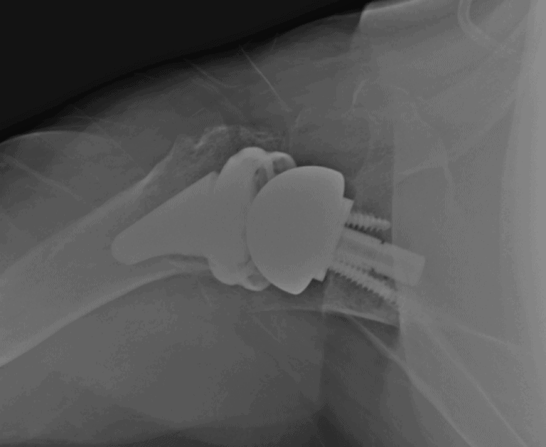 Arthrex - Short - Reverse<br><span>Click image to see a larger version.</span>