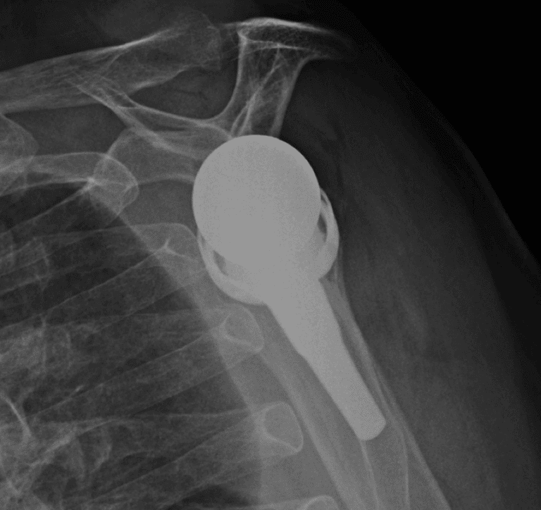 Arthrex - Short - Reverse<br><span>Click image to see a larger version.</span>