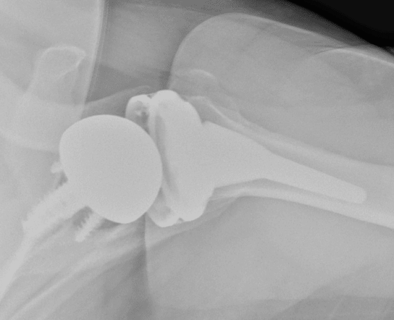 Arthrex - Standard - Reverse<br><span>Click image to see a larger version.</span>