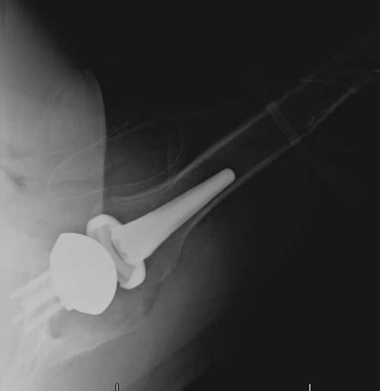 Exactech - Short - Reverse<br><span>Click image to see a larger version.</span>