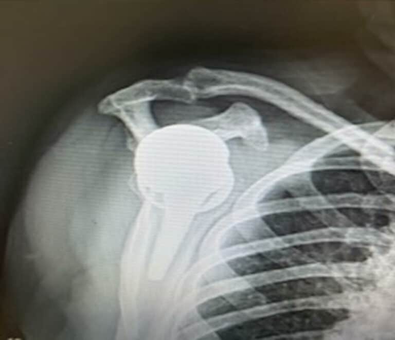 Exactech - Short - Reverse<br><span>Click image to see a larger version.</span>