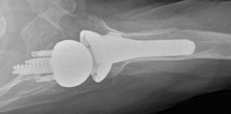 DJO/Enovis - Standard - Reverse<br><span>Click image to see a larger version.</span>