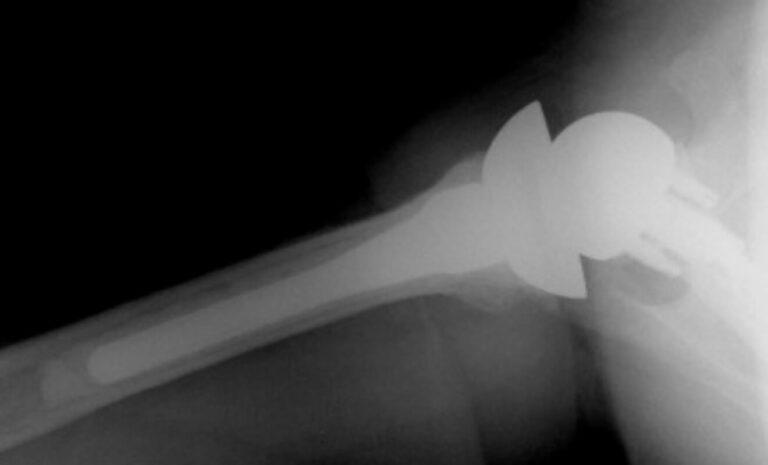 DJO/Enovis - Standard - Reverse<br><span>Click image to see a larger version.</span>