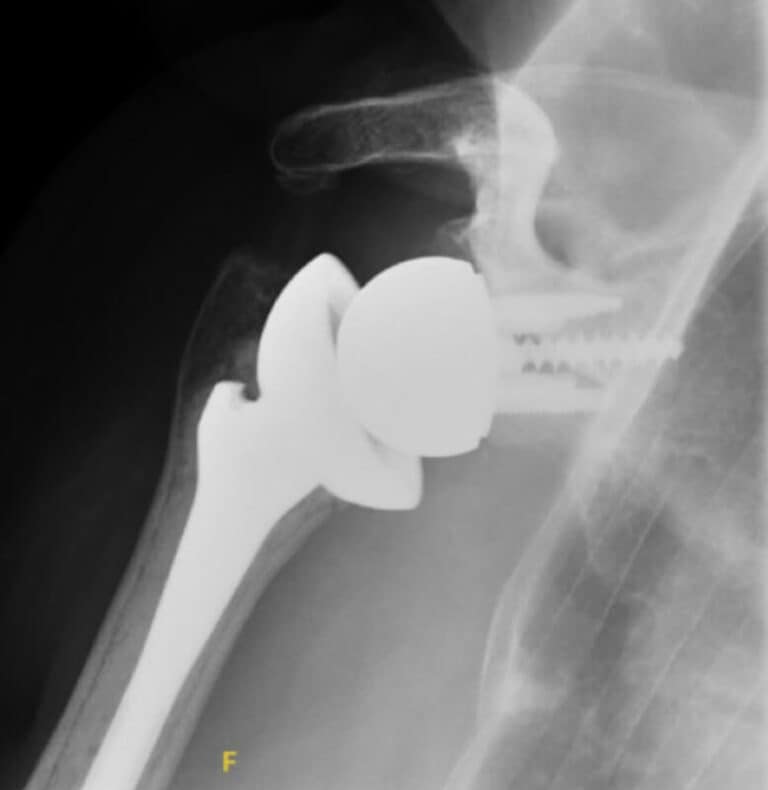 DJO/Enovis - Standard - Reverse<br><span>Click image to see a larger version.</span>