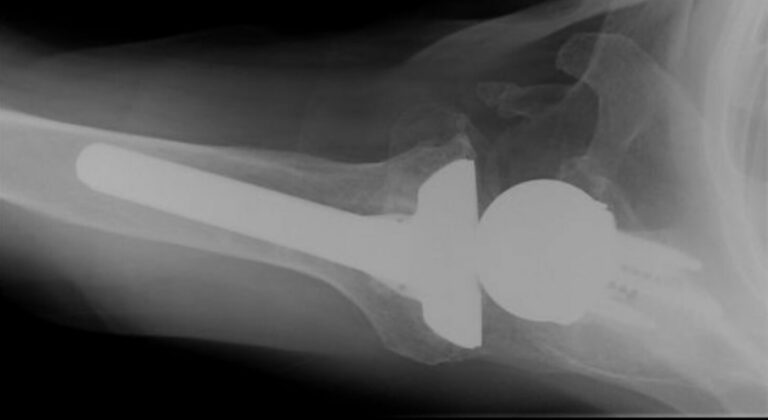 DJO/Enovis - Standard - Reverse<br><span>Click image to see a larger version.</span>