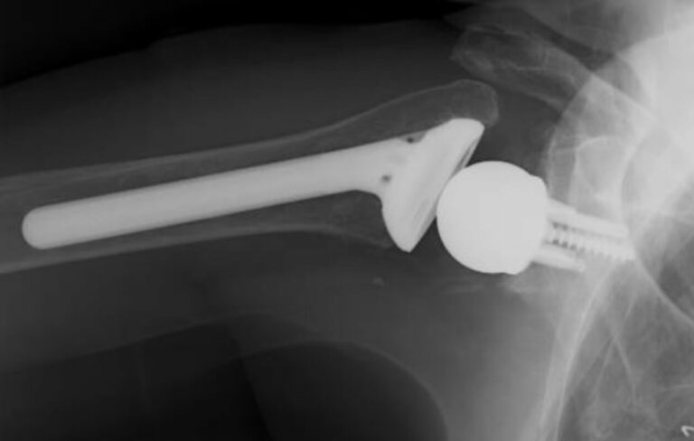 DJO/Enovis - Standard - Reverse<br><span>Click image to see a larger version.</span>