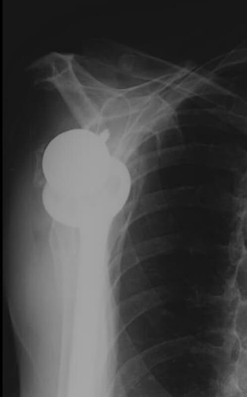 DJO/Enovis - Standard - Reverse<br><span>Click image to see a larger version.</span>