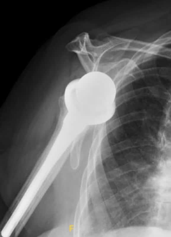 DJO/Enovis - Standard - Reverse<br><span>Click image to see a larger version.</span>