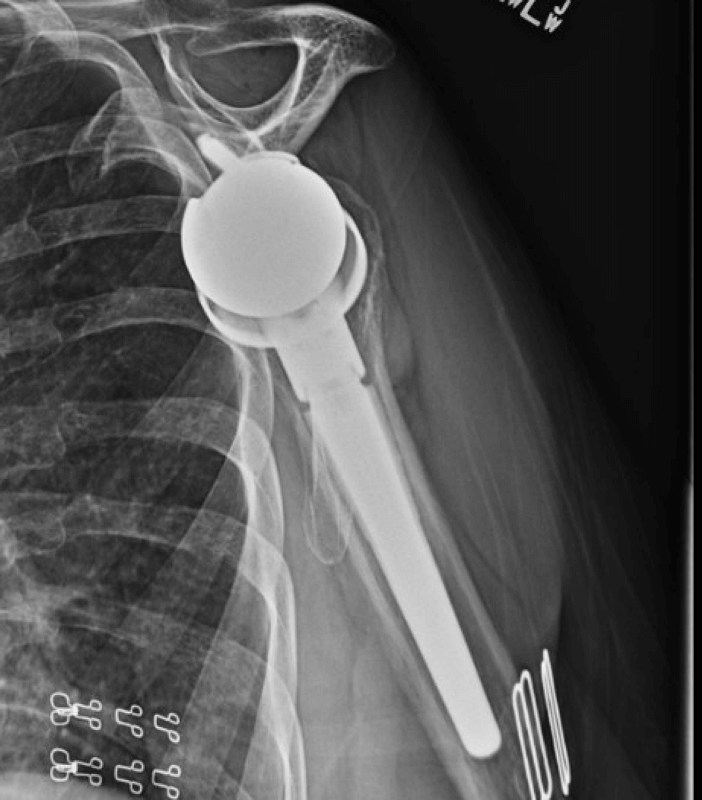 Lima - Standard - Reverse<br><span>Click image to see a larger version.</span>