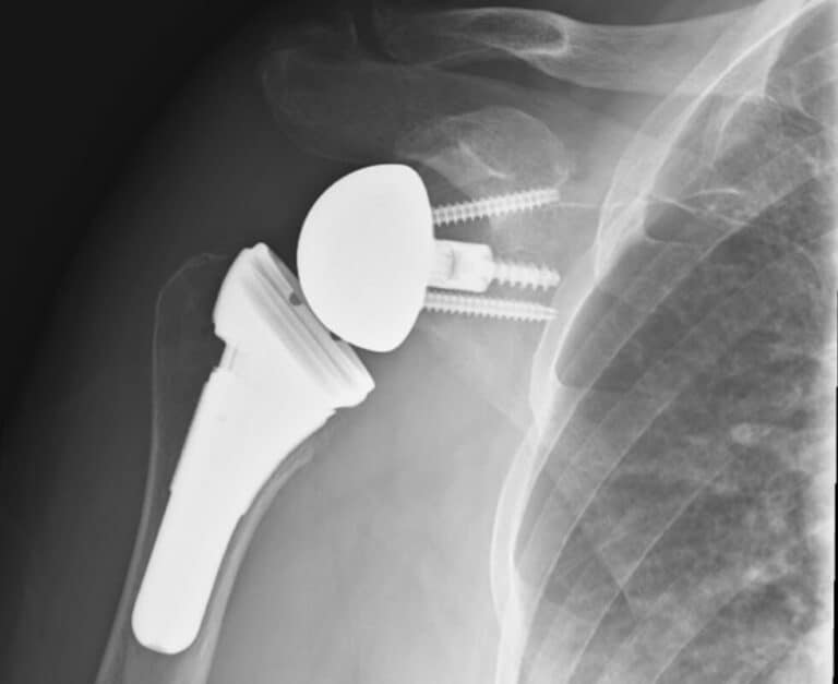 DePuy - Short - Reverse<br><span>Click image to see a larger version.</span>