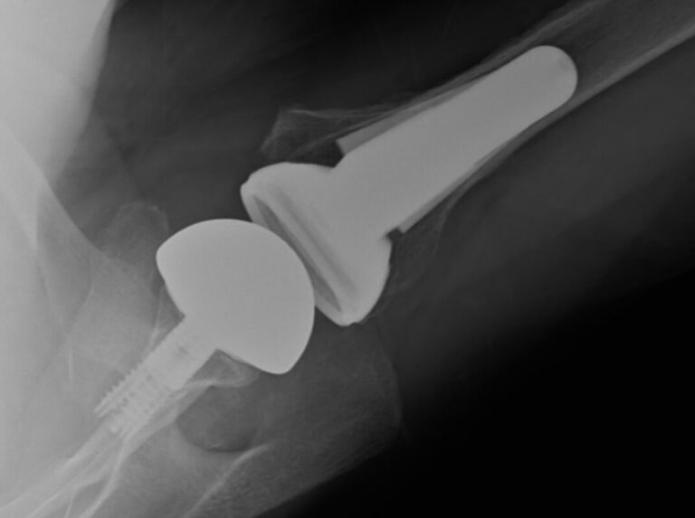 DePuy - Short - Reverse<br><span>Click image to see a larger version.</span>