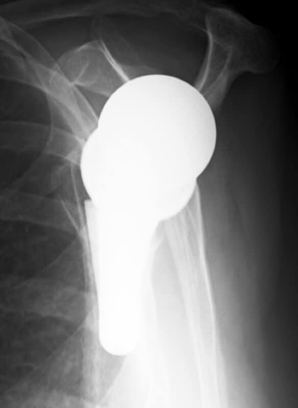 DePuy - Short - Reverse<br><span>Click image to see a larger version.</span>