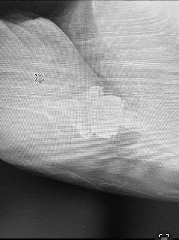 Shoulder Innovations - Short - Reverse<br><span>Click image to see a larger version.</span>