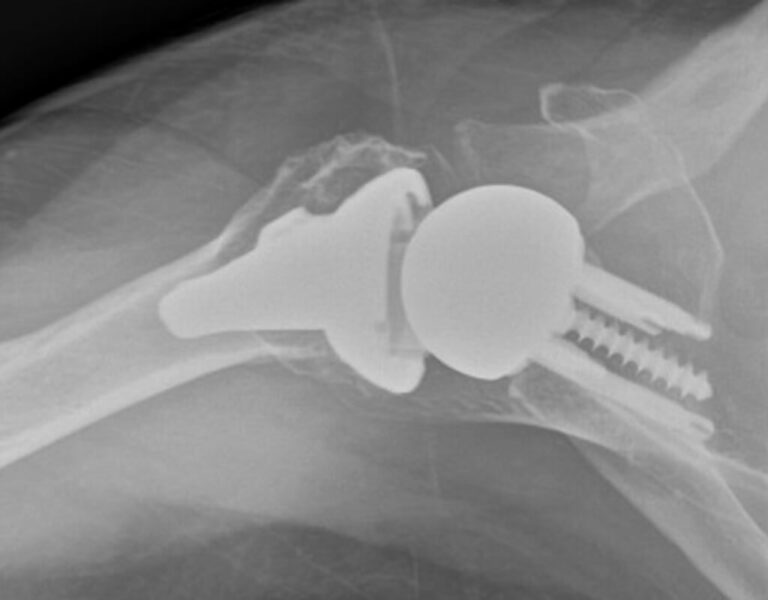 DJO/Enovis - Short - Reverse<br><span>Click image to see a larger version.</span>