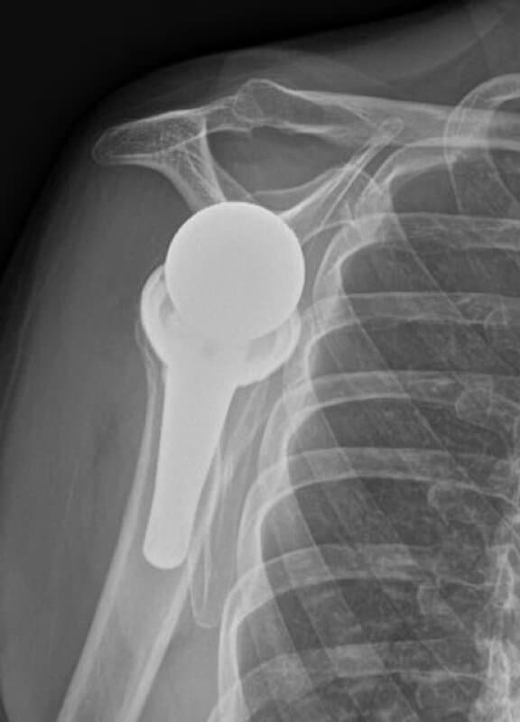 DJO/Enovis - Short - Reverse<br><span>Click image to see a larger version.</span>