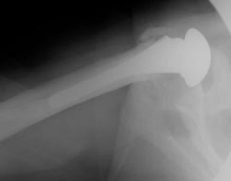 DJO/Enovis - Standard - Anatomic<br><span>Click image to see a larger version.</span>