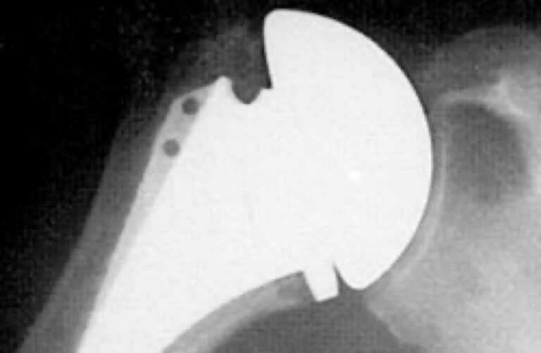 DJO/Enovis - Standard - Anatomic<br><span>Click image to see a larger version.</span>