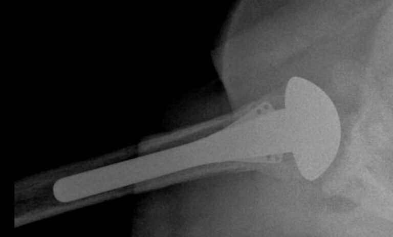 DJO/Enovis - Standard - Anatomic<br><span>Click image to see a larger version.</span>