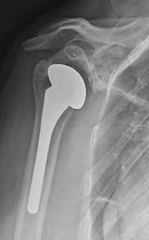 DJO/Enovis - Standard - Anatomic<br><span>Click image to see a larger version.</span>