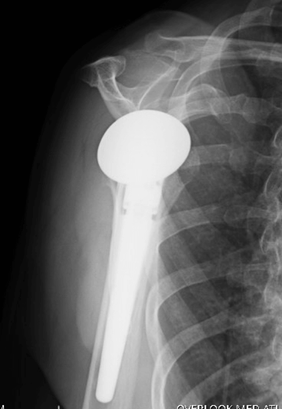 Lima - Standard - Anatomic<br><span>Click image to see a larger version.</span>