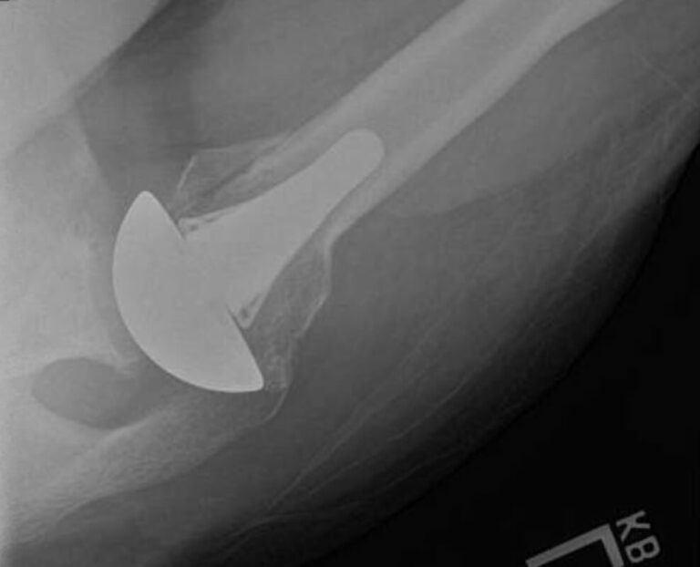 DJO/Enovis - Short - Anatomic<br><span>Click image to see a larger version.</span>