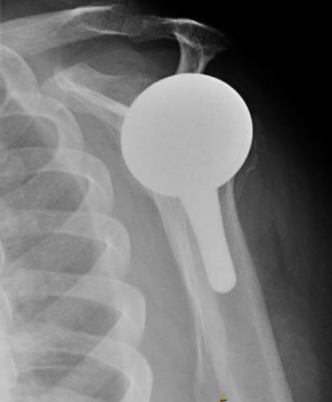 DJO/Enovis - Short - Anatomic<br><span>Click image to see a larger version.</span>