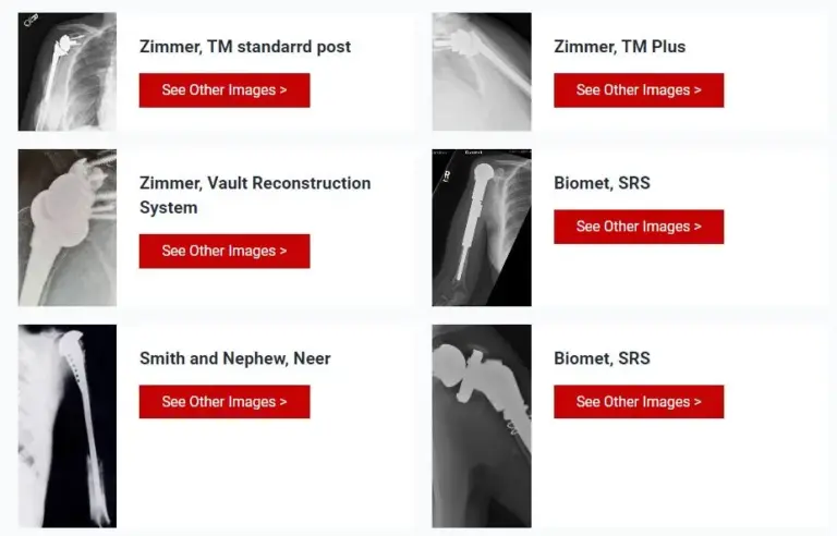 Radiographic Library 4